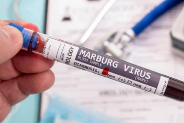 Virus de Marburgo: síntomas de la peligrosa enfermedad hemorrágica que está causando un brote en Tanzania