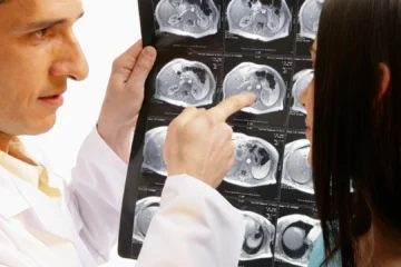 El cáncer olvidado que aumenta entre los jóvenes y desconcierta a los expertos
