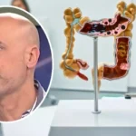 El médico Fernando Fabiani explica los factores de riesgo de padecer cáncer de colon: &quot;A partir de los 50 empieza a ser frecuente&quot;