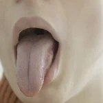 Esto es lo que dice el aspecto de tu lengua sobre tu estado de salud
