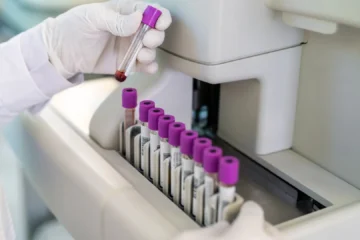¿Qué es la trombocitosis? Causas, primeros síntomas y tratamientos