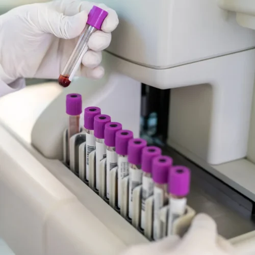 ¿Qué es la trombocitosis? Causas, primeros síntomas y tratamientos