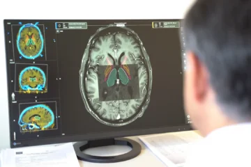 La cera de los oídos, una posible forma sencilla para la detección del párkinson