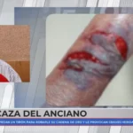 José, de 88 años, víctima de una brutal agresión: «Solo pido poder sentarme tranquilo en un banco»