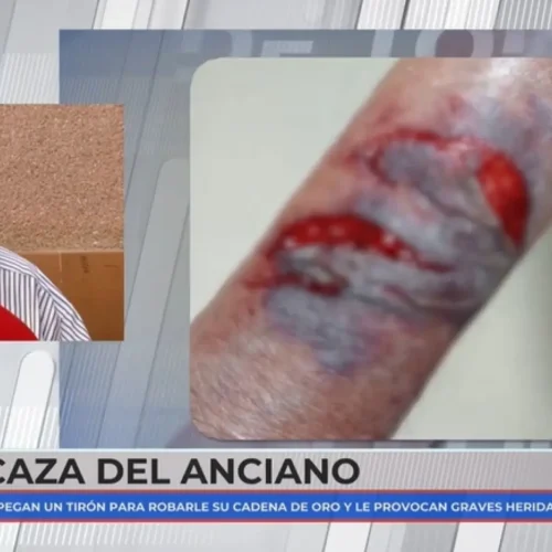 José, de 88 años, víctima de una brutal agresión: «Solo pido poder sentarme tranquilo en un banco»