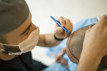 Muere un hombre tras realizarse un trasplante capilar: estos son los riesgos y efectos secundarios más comunes