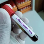 Científicos de Barcelona desarrollan una molécula que podría evitar los síntomas de la enfermedad celíaca