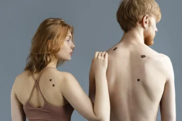 La AECC asegura que vigilar los lunares y manchas en la piel es el mejor control de los melanomas