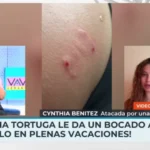 Una tortuga muerde el glúteo a una modelo española en Zanzíbar: «Había un alga detrás y se confundió»