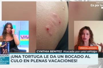 Una tortuga muerde el glúteo a una modelo española en Zanzíbar: «Había un alga detrás y se confundió»