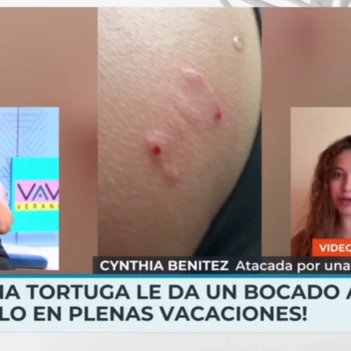 Una tortuga muerde el glúteo a una modelo española en Zanzíbar: «Había un alga detrás y se confundió»